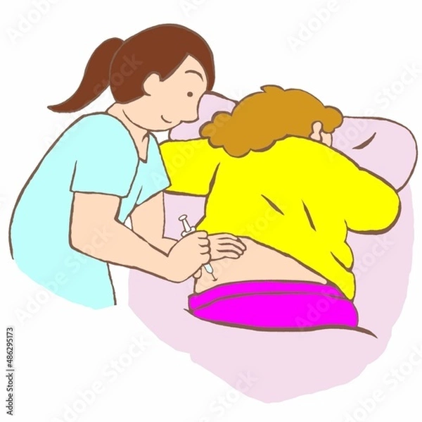 Obraz 持効性注射剤の筋肉注射を受ける双極性障害の女性のイラスト