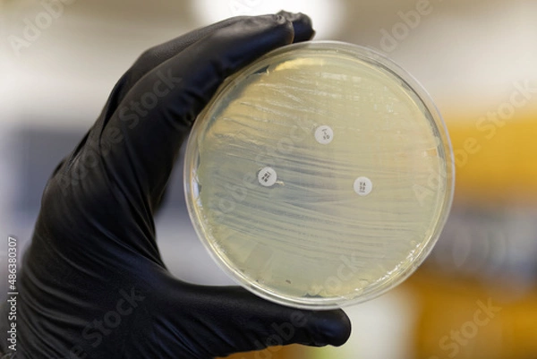 Fototapeta A Pertri plate showing the resistance of bacteria to antibiotics. If the bacteria is resistant the zone of inhibition will not form.