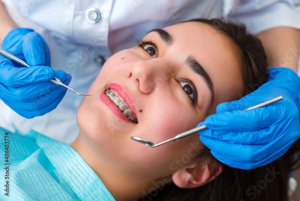Fototapeta Close up of woman with brackets receiving dental braces treatment in clinic. Orthodontist using dental mirror and forceps while putting orthodontic braces on patient teeth. Concept of dentistry.