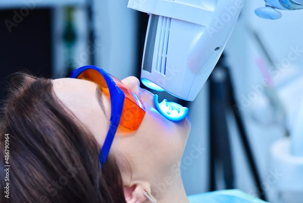 Obraz Teeth whitening for patient.