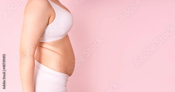 Fototapeta a fat girl holding a hand with excess fat on her stomach on a pink background. the concept of a woman's lifestyle with a diet to reduce the belly. recovery after childbirth. place for text