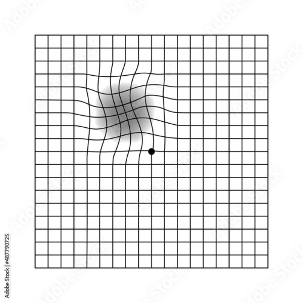 Obraz Amsler eye scotoma test grid. Vector printable chart retina examination. Grid with dot in centre. Vision control. Eye check amsler grid test