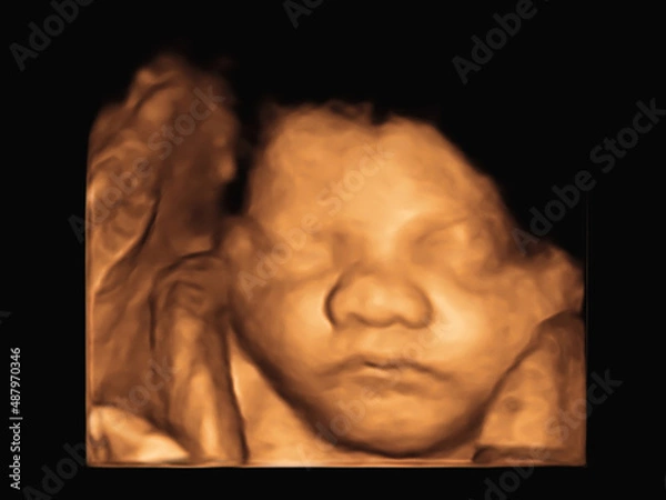 Fototapeta image Ultrasound 3D4D of baby in mother's womb.