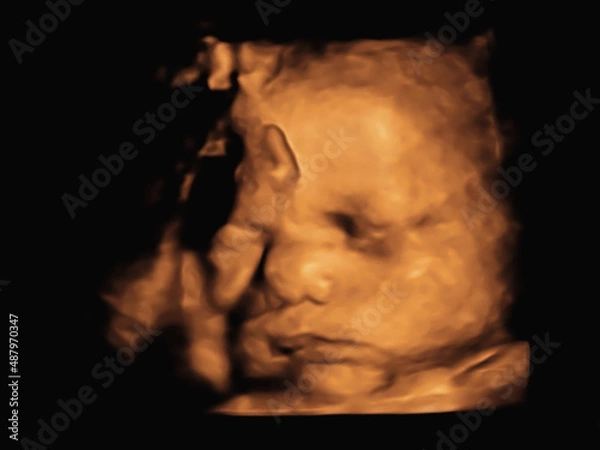 Fototapeta image Ultrasound 3D4D of baby in mother's womb.