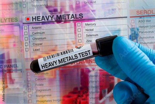 Fototapeta Blood tube test with requisition form for heavy metals test. Blood sample tube for analysis heavy metals in laboratory