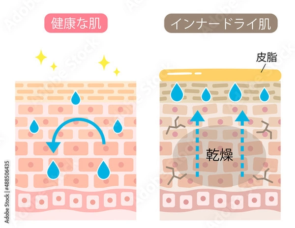 Obraz インナードライ　肌細胞　ビフォアアフター　