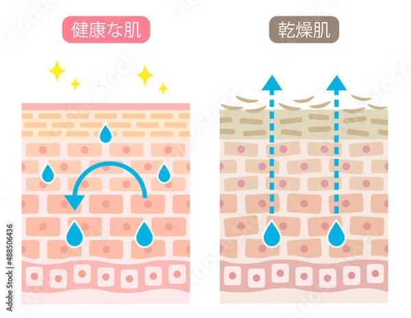Obraz 乾燥肌　断面　ビフォアアフター