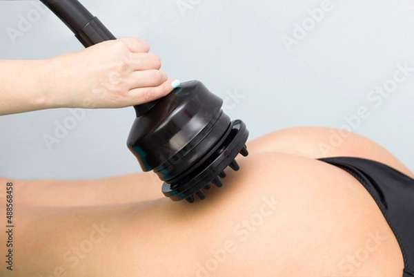 Obraz Anti-cellulite vibrating G5 massage. Subdermal therapy.