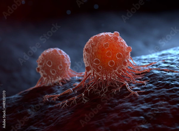 Fototapeta A migrating cancer cells