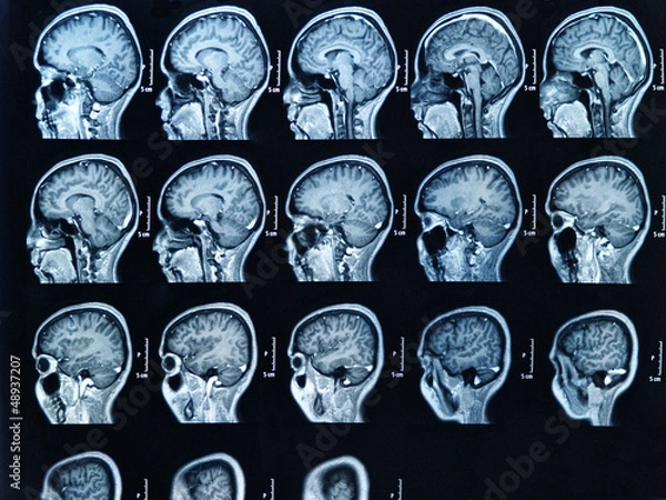 Fototapeta MRI Brain Scan