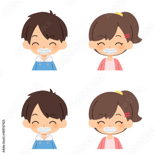 Obraz 歯列矯正をする子供たち