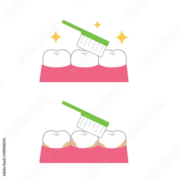 Obraz 歯と歯ブラシ