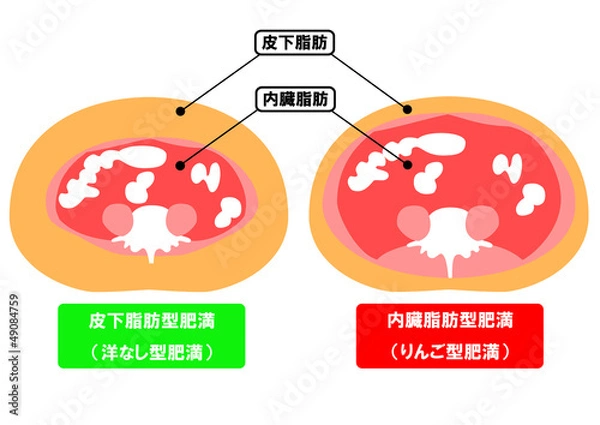 Obraz 内臓脂肪と皮下脂肪の断面図