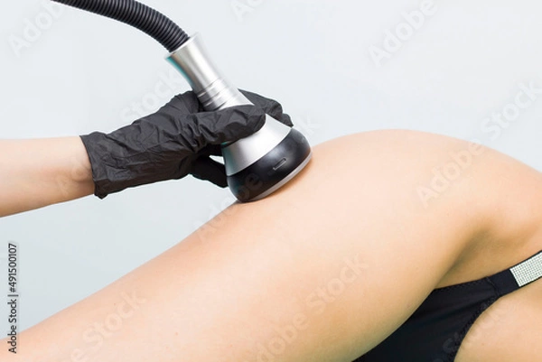 Obraz Rf skin tightening. Vacuum massage. Hardware cosmetology. Body care. Non surgical body sculpting. anti-cellulite and anti-fat therapy in beauty salon..