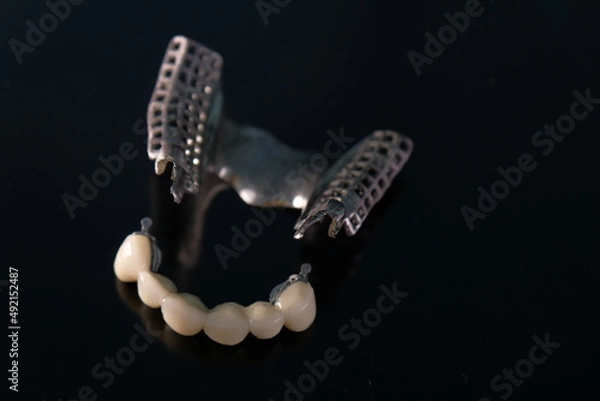 Obraz Metal Free Ceramic Dental Crowns. Ceramic zirconium in final version. Staining and glazing. Precision design and high quality materials.