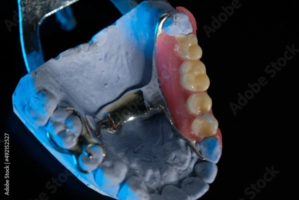 Obraz Removable plastic partial denture on white background