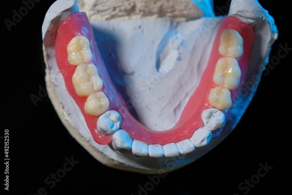 Obraz Removable plastic partial denture on white background