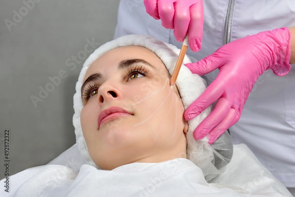 Fototapeta Thread lifting. Tightening of flabby skin in the jaw area with the help of cosmetic threads. The doctor prepares the patient for the procedure by drawing stripes with a white pencil