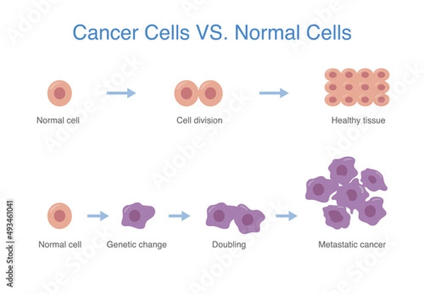 Obraz Compare between devenlop of healthy cell and cancer cell. Medical and science diagram about abnormal cells grow.