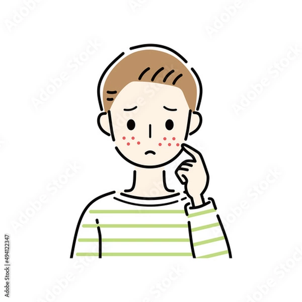 Fototapeta 男性　ニキビ　吹き出物