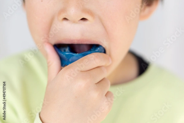 Obraz 日本人の子供の歯列矯正の写真