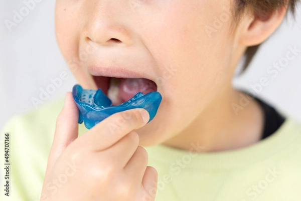 Obraz 日本人の子供の歯列矯正の写真