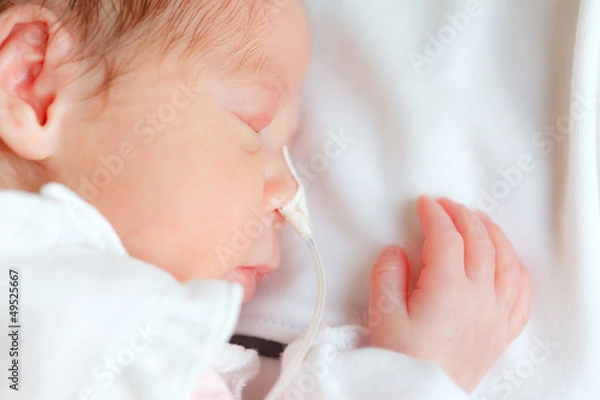 Obraz premature infant