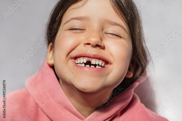 Fototapeta portrait of a beautiful emotional caucasian girl in a pink sweatshirt who lost her first tooth. Close-up of a child with a smile and joy