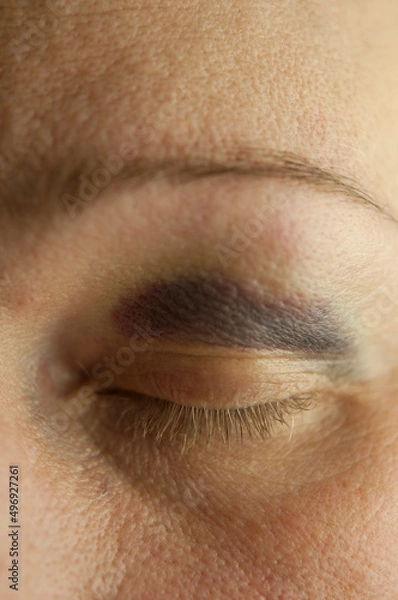 Fototapeta Sad beaten up girl with wounds on the face looking at the camera with deep look