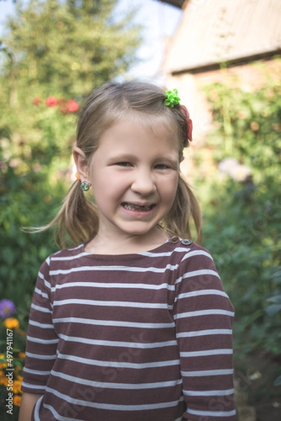 Fototapeta Child with a dental orthodontic device and without one tooth