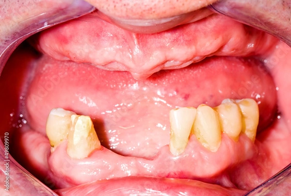 Obraz Tootles maxilla