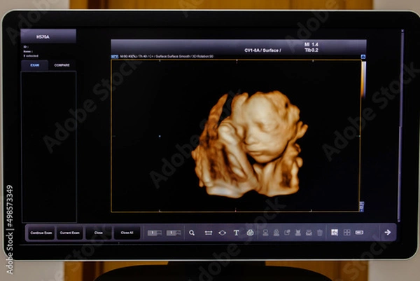 Fototapeta Picture 4D with Ultrasound of baby in mother's womb show the face.