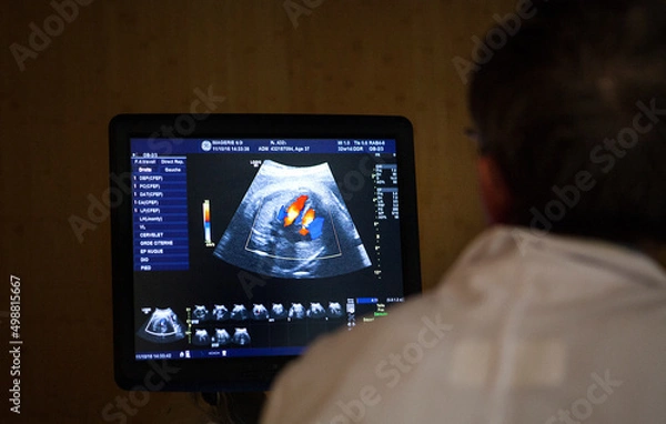 Fototapeta A doctor radiologist performs an ultrasound of the third trimester.