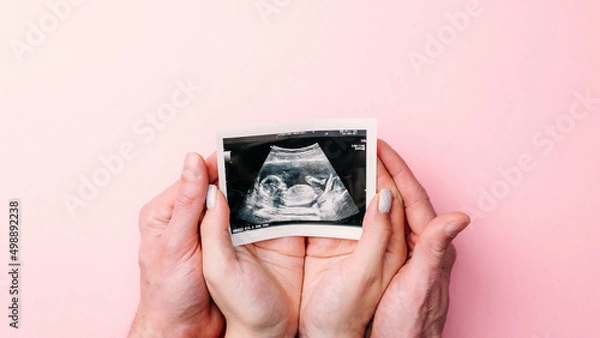 Fototapeta Ultrasound image pregnant baby photo. Woman hands holding ultrasound pregnancy picture on pink background. Pregnancy, medicine, pharmaceutics, health care and people concept.