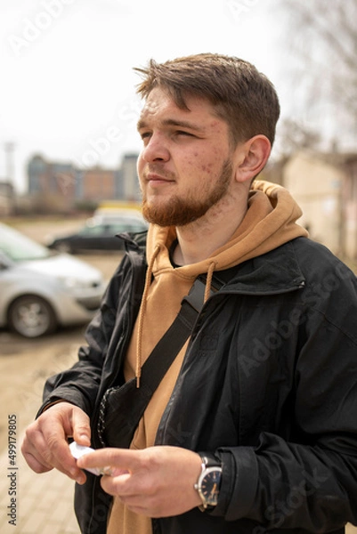 Fototapeta guy with a beard looks dreamily into the distance in a jacket pimples on his face portrait

