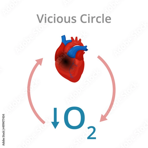 Obraz Vicious circle simplified vector diagram.
