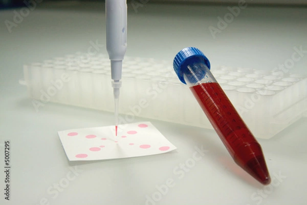 Fototapeta blood test