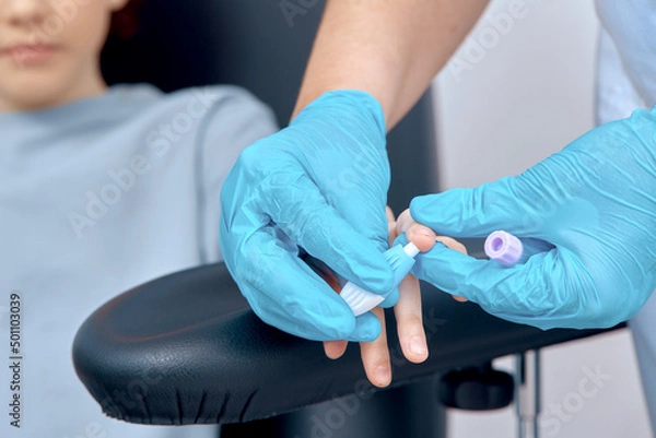 Obraz the process of taking a blood test from a child from a finger