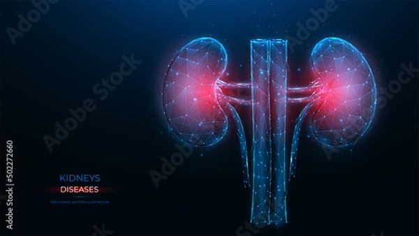 Obraz Polygonal vector illustration of an inflamed human kidney on a dark blue background. Diseases of the organs of the excretory system concept. Urological or nephrological template, or banner.