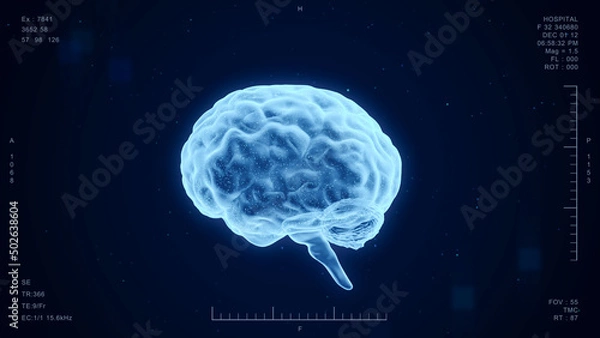 Fototapeta Human brain medical diagnosis interface, futuristic ct scan hologram science and research technology, AI computer screen 3d rendering