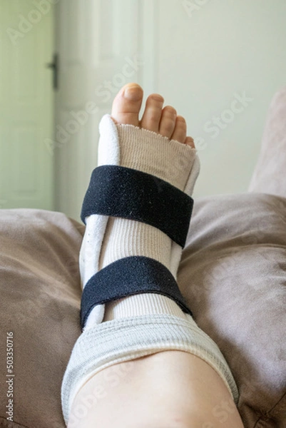 Fototapeta Close-up of a woman's foot which is injured and is wearing a brace and crutches