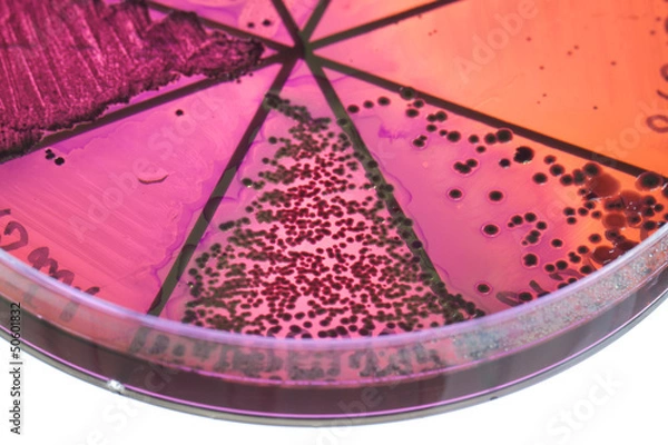 Obraz Bacteria on petri dish