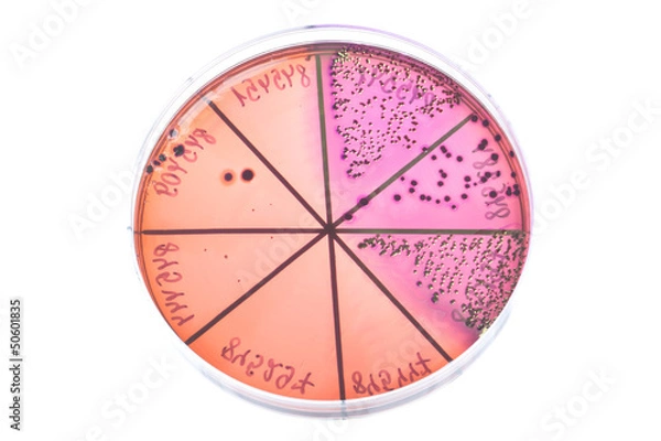 Obraz Bacteria on petri dish