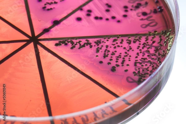 Obraz Bacteria on petri dish