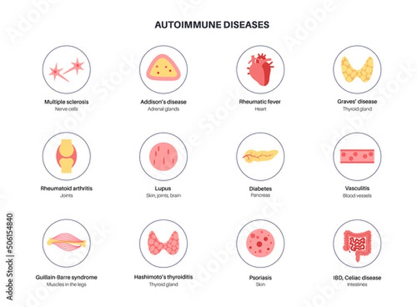 Obraz Autoimmune disorders diseases