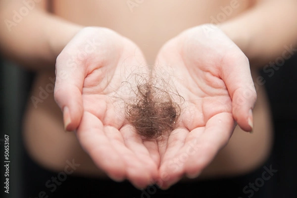 Obraz Hair loss