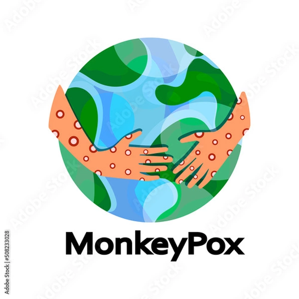 Fototapeta Monkeypox virus. Eruption on the body. Monkey Pox virus disease symptoms on hands rash infection. Global pandemic in the world. Vector illustration isolated