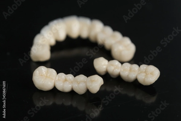 Fototapeta Dental ceramic bridge on isolated wite background. Metal free ceramic dental crowns.  Closeup ceramic to dental implants in laboratory.