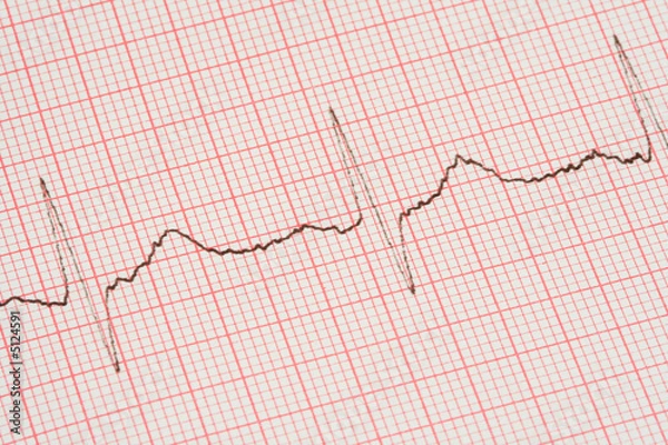 Fototapeta ECG printout