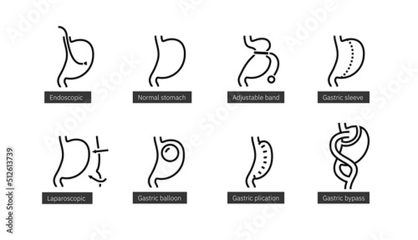 Fototapeta Set of line icons of bariatric surgery methods. Endoscopy and laparoscopy operations on stomach for weight loss.